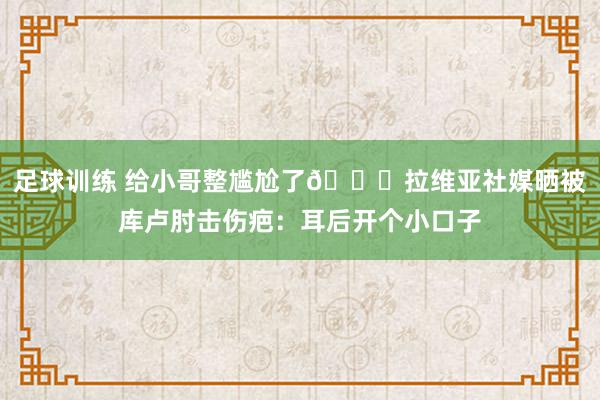 足球训练 给小哥整尴尬了😅拉维亚社媒晒被库卢肘击伤疤：耳后开个小口子